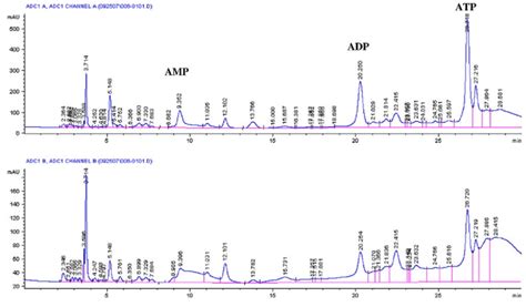 Hplc Pattern Of Lithium Treated Rat Brain Extract Download Scientific