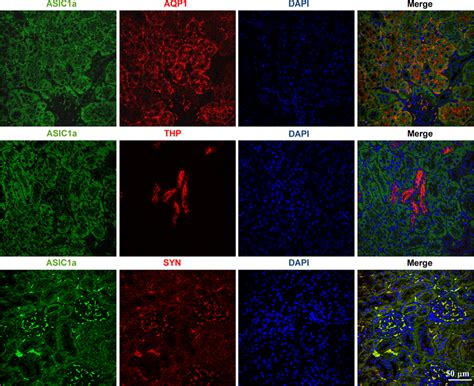 Immunohistochemical Analysis Of Asic A Expression In Renal Tissue