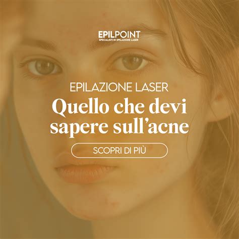 Acne Ed Epilazione Laser Cosa Sapere Epil Point Italia Epil Point