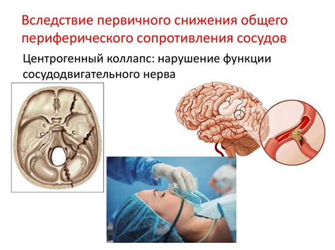 Коллапс. Причины коллапса - презентация онлайн