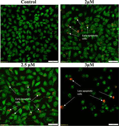 Confocal Microscopy Images Of Hela Cells Treated With Different Doses