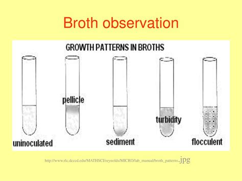 Culturing Microorganism Pure Culture One Consisting Of A Single Type