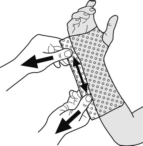 Guide Wrist immobilization splint - Orfit Industries