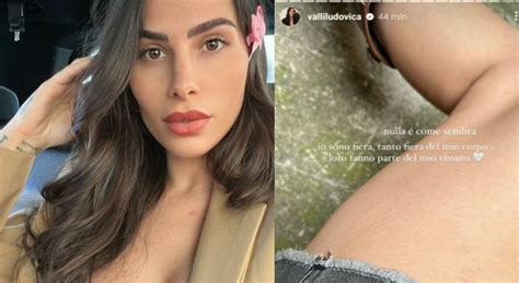 Ludovica Valli Mostra Le Smagliature Su Instagram Dopo Il Secondo