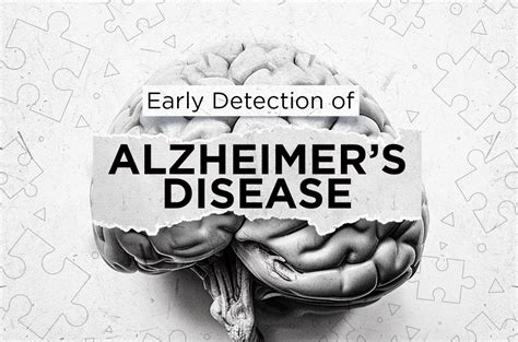 Early Detection Of Alzheimer S Disease Comanche County Memorial