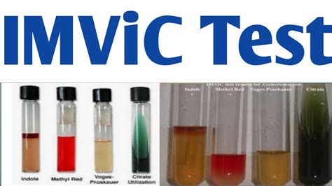 Imvic Test Principle Result Chart Examples Uses Off