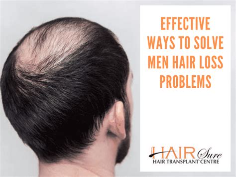 Effective Ways To Solve Men Hair Loss Problems - Cyber Hairsure