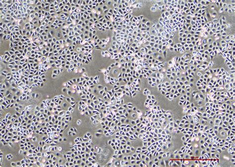 人食管鳞癌细胞 Kyse 30（str鉴定正确）细胞系细胞库旗赛生物科技（武汉）有限公司