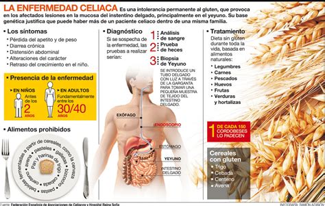 En Argentina Una De Cada Personas Es Diagnosticada Con Celiaqu A