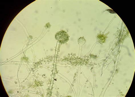 Aspergillus Oryzae Morphology Usage And Genetics Mold Busters