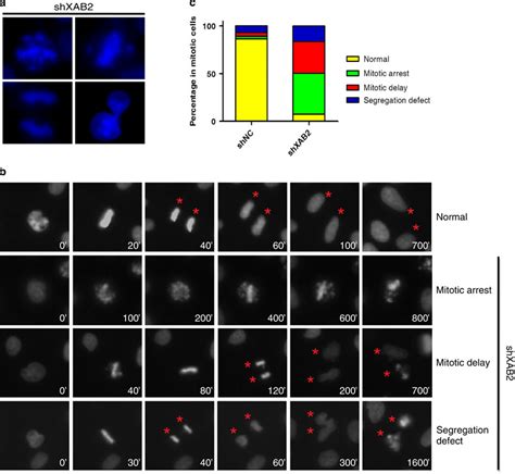 XAB2 Knockdown Leads To Chromosome Misalignment And Missegregation A