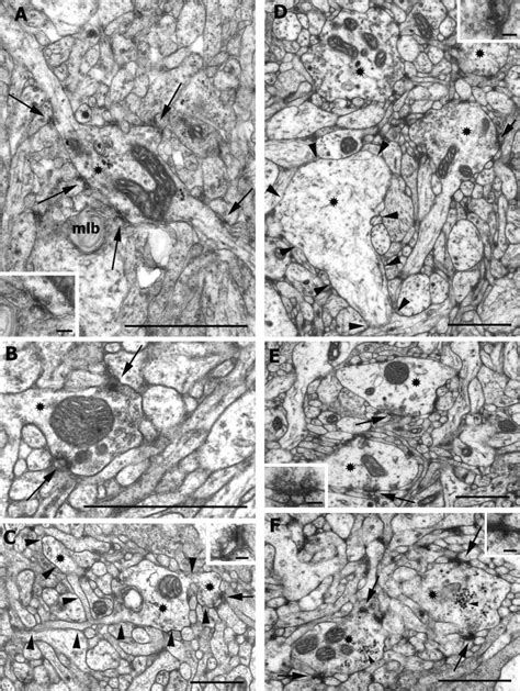 Glial Cells In The Lip Region At Stages P A P B And P C The