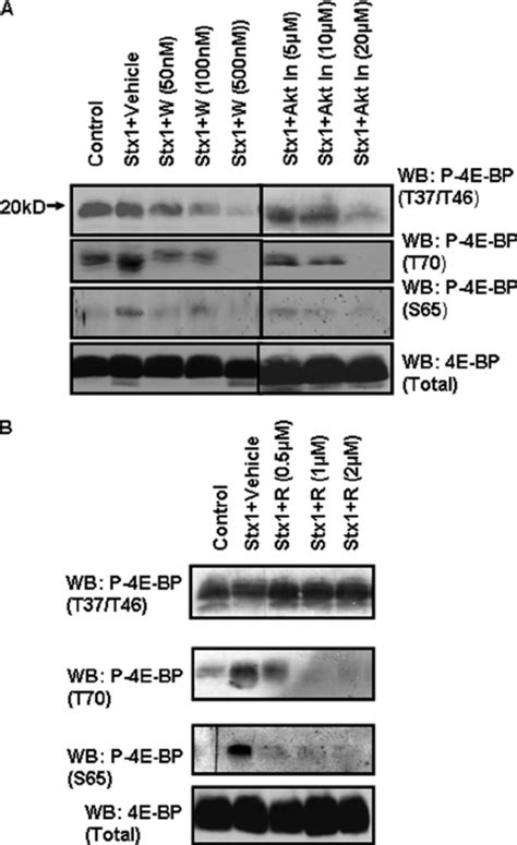 Pi K Akt And Mtor Inhibitors Block E Bp Phosphorylation Thp Cells