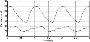 In Vitro Hemodynamic Model Of The Arm Arteriovenous Circulation To