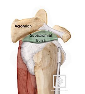 Shoulder / ПЛЕЧИ: Subacromial Impingement