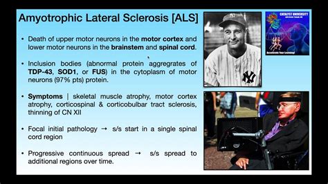 Amyotrophic Lateral Sclerosis ALS Basics Clinical Presentation