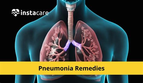 12 Natural Remedies To Treat Pneumonia Quickly And Effectively