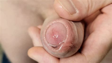 Uncut Wet Foreskin Close Up Cock Xhamster