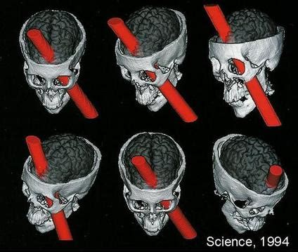 What happens if it's damaged? - The Frontal Lobe