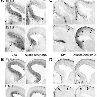 Dicer Ablation Using The Emx Cre Nestin Cre And Nex Cre Lines At