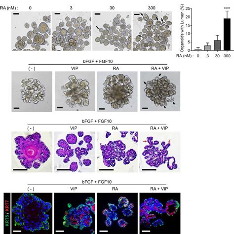 D Organoid Culture From Adult Salivary Gland Tissues As An Ex Vivo