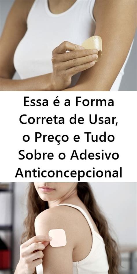 Adesivo Anticoncepcional O que é Como Usar e Preço