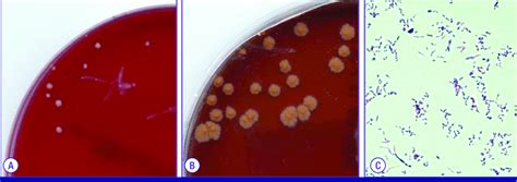 Colonies On Blood Agar Showed Small Orange Colored Convex Colonies