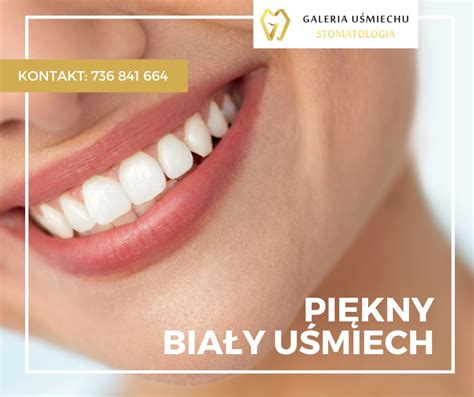 Piękny biały uśmiech Galeria Uśmiechu Opole Dentysta Przemysław Rapa