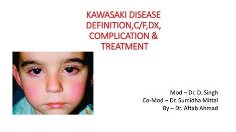 Kawasaki Disease Ppt