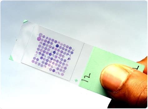 Types of Microarray