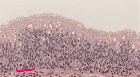 Epithelia Connective Tissue And Muscle Lab Flashcards Quizlet