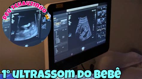 1º Ultrassom De 12 Semanas Do Bebê 😍 Youtube