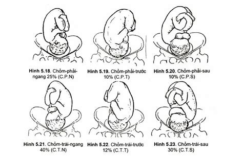 The Crown Test And What You Need To Know Vinmec