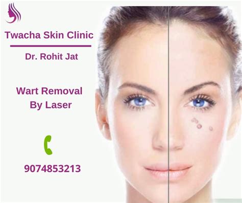 Twacha Skin Clinic Twachaskincare Twitter