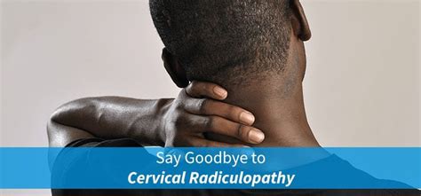 Cervical Radiculopathy Physical Therapy What To Expect