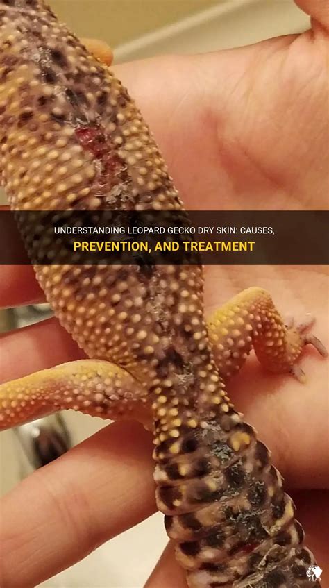 Understanding Leopard Gecko Dry Skin Causes Prevention And Treatment