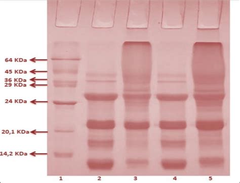 Sds Page Electrophoretic Profiles For 1 Solution With Protein