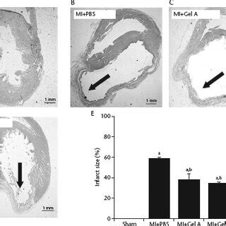 Haematoxylin And Eosin H E Stained Sections And Quantification Of