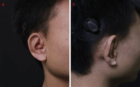 Aesthetic Appearance Of The Anterior Left Panel A And Posterior