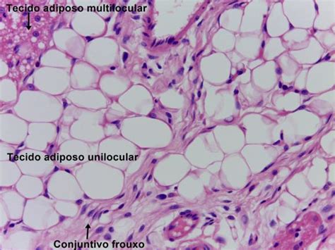 ベスト tecido conjuntivo adiposo 652568 Tecido conjuntivo adiposo