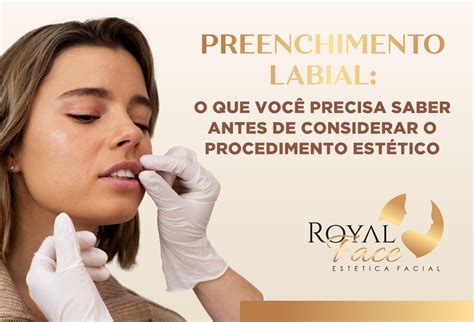 O Que Você Precisa Saber Antes De Fazer O Preenchimento Labial