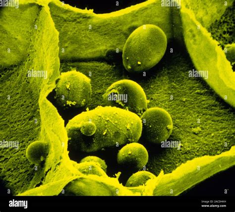 False Colour Scanning Electron Micrograph Sem Of A Single Broken