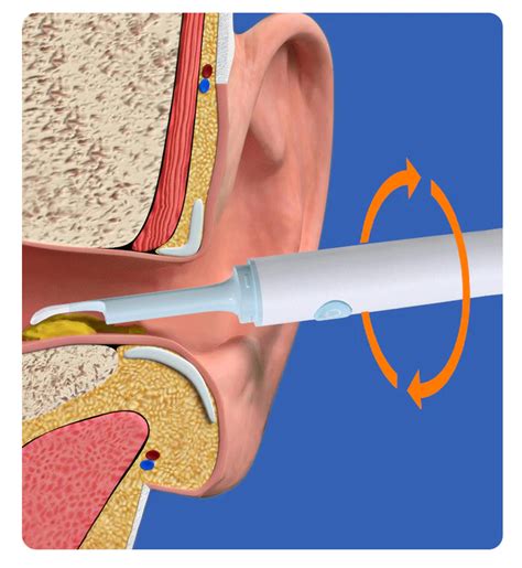 Otoskop Laryngologiczny Z Kamerk Badanie Uszu Eartpick Wifi Vigomed