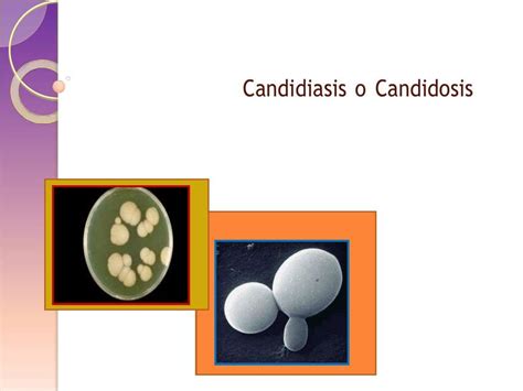 Histolog A De Candida Albicans