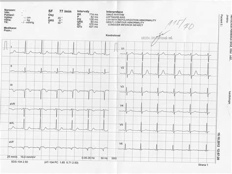 EKG z praxe 22 Medicína nemoci studium na 1 LF UK