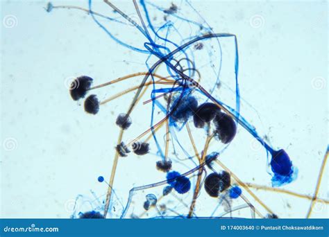 Rhizopus Bread Mold Under The Microscope Stock Photo Image Of Biology