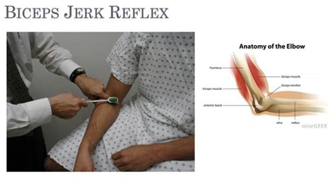 CP OSCE Neurosciences Upper Limb Exam Flashcards Quizlet