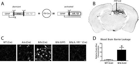 Chronic Interleukin 1β Expression In Mouse Brain Leads To Leukocyte