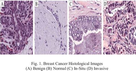 Figure 1 From Breast Cancer Histological Images Nuclei Segmentation