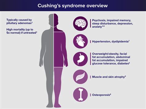 Treatment for Cushing's Syndrome - Philadelphia Homeopathic Clinic